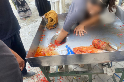 Elini Salça Makinesine Kaptırdı