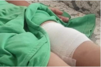 Sahipsiz Köpek Çocuğa Saldırdı