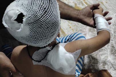 Sahipsiz Köpek Çocuğu Yaraladı